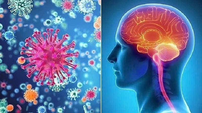Doctor say meningococcal disease can be life-threatening and progress rapidly., and without timely treatment, the fatality rate can reach up to 50% within 24 to 48 hours.