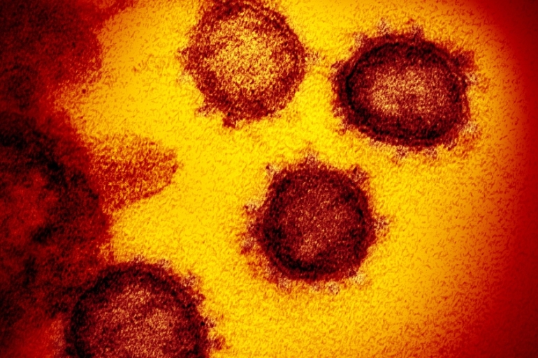 Researchers: Covid-19 can remains infectious on banknotes,  mobile screen for 28 days