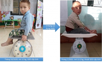 World Vision supports malnourished children in Dien Bien Province