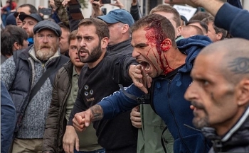 uk nine cops injured as square and park bombarded by thousands of maskless protesters