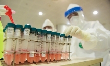 chinese man arrested for illegal covid 19 testing in peru